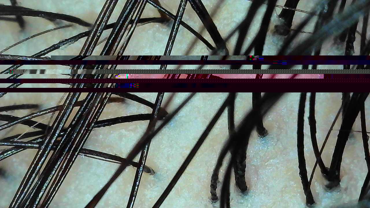 Magnified scalp capture at the crown